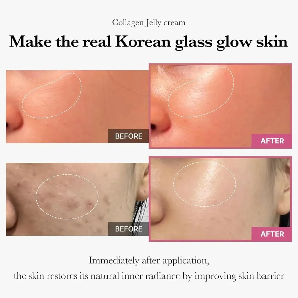 Hoygi Barely 5 Skin Lift Collagen Jelly Cream