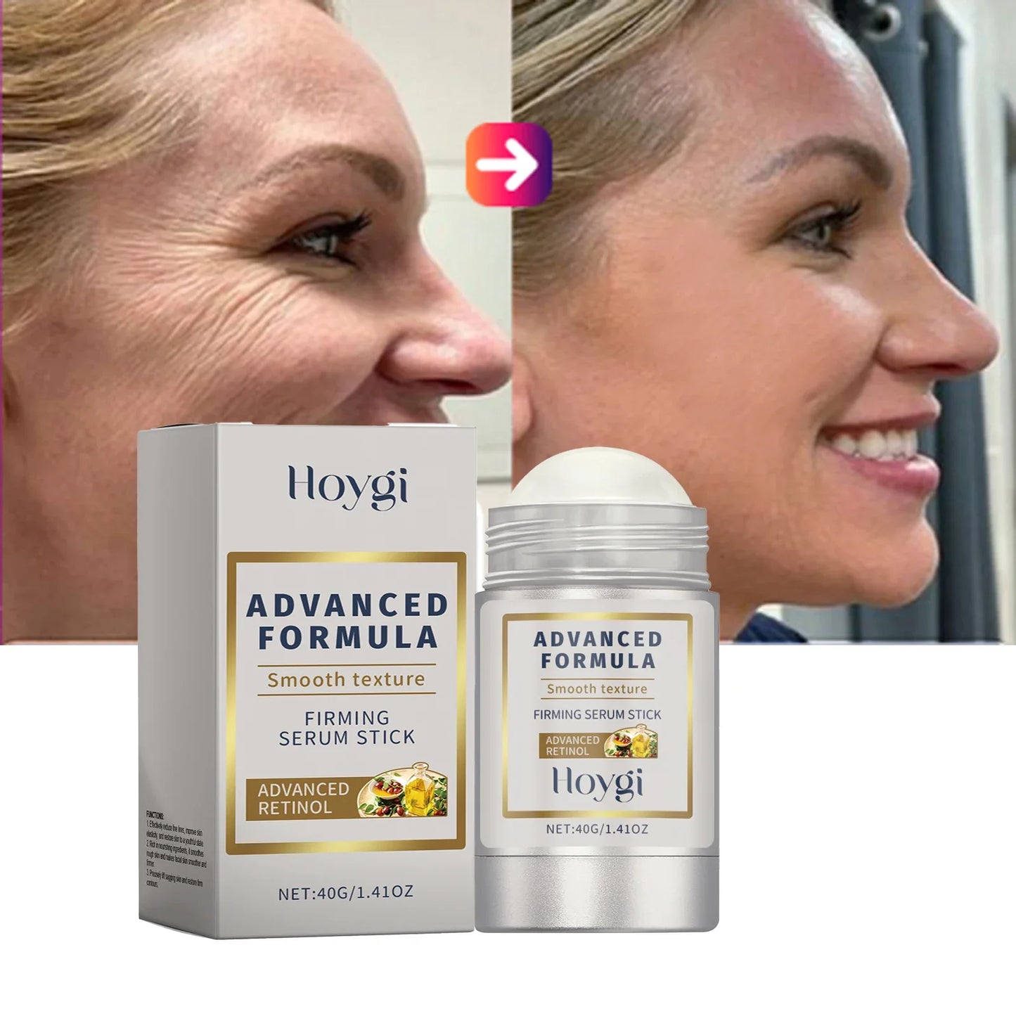 Hoygi TimeLift Radiance Serum