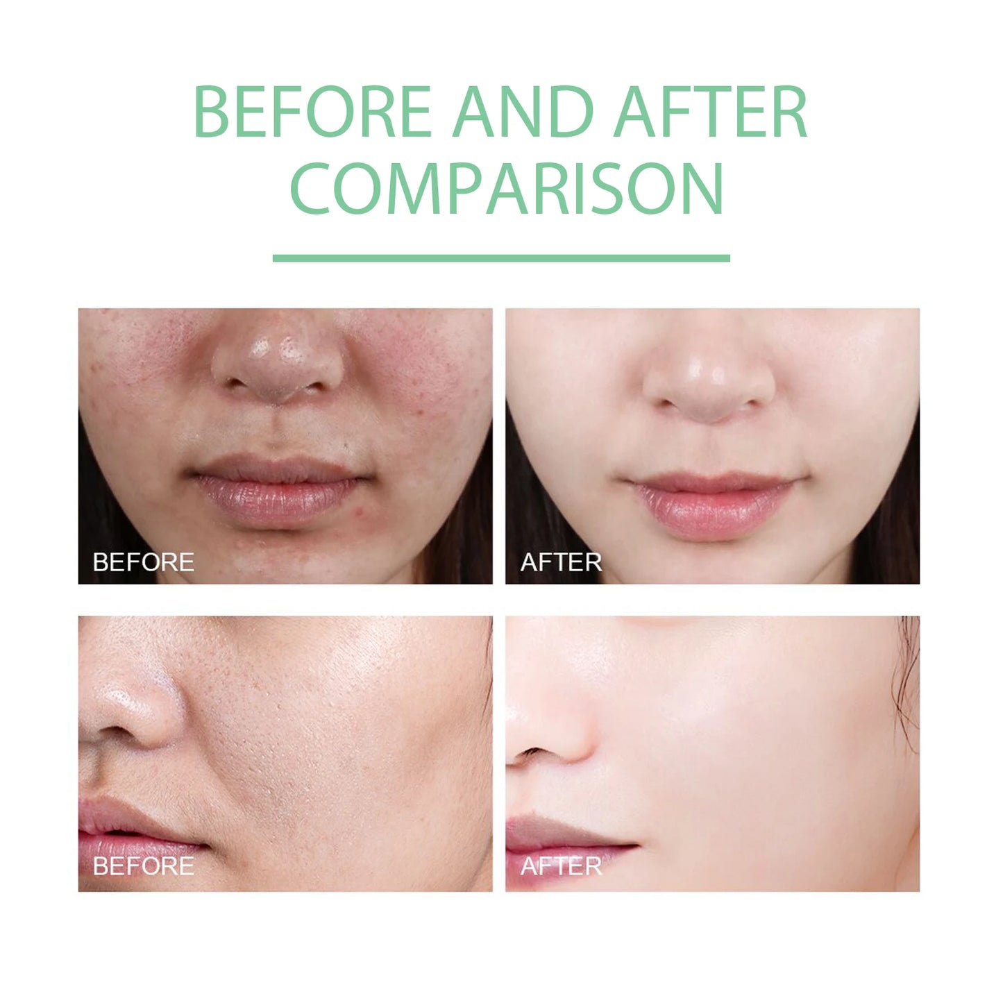 Herbal Exfoliating Gel
